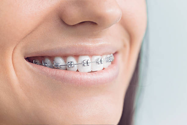 Reliable Mount Kisco, NY Dental Services Solutions